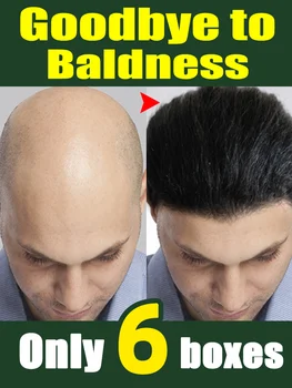 Plaukų augimo naftos remontas paveldimas po gimdymo seborėjinis plaukų slinkimas Greitą plaukų augimą aliejus