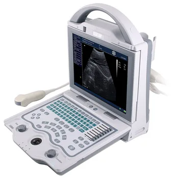 BT-UD60 Kinija pigūs ligoninės medicinos įrangos, Nešiojamųjų balta ir juoda nešiojamas Ultragarsinis skeneris Mašina